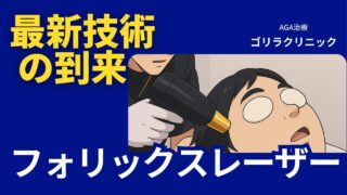 【せいやの薄毛治療体験】ゴリラクリニックの最新フォリックスレーザー治療とその費用を徹底解説！ 
